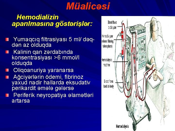 Müalicəsi Hemodializin aparılmasına göstərişlər: Yumaqcıq filtrasiyası 5 ml/ dəqdən az olduqda Kalinin qan zərdabında