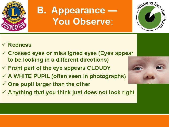 B. Appearance — You Observe: ü Redness ü Crossed eyes or misaligned eyes (Eyes