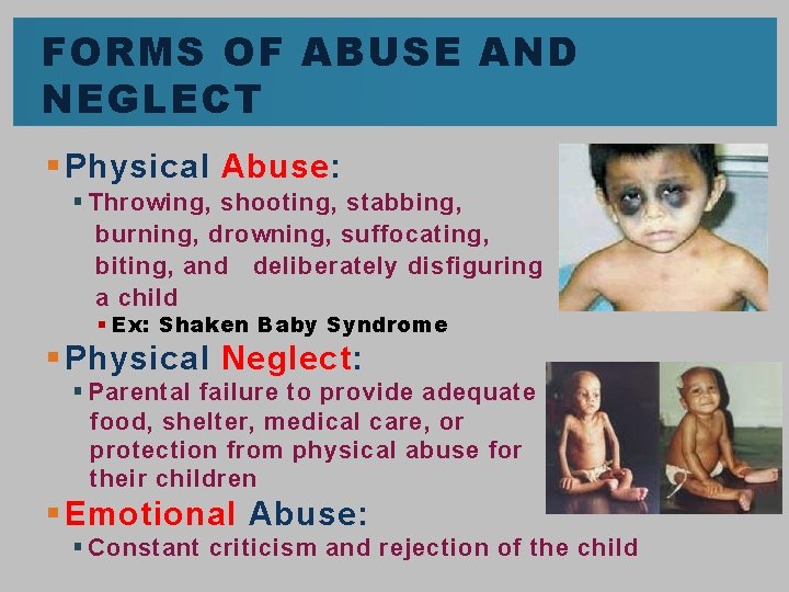FORMS OF ABUSE AND NEGLECT § Physical Abuse: § Throwing, shooting, stabbing, burning, drowning,