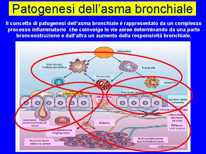 Patogenesi dell’asma bronchiale Il concetto di patogenesi dell’asma bronchiale è rappresentato da un complesso