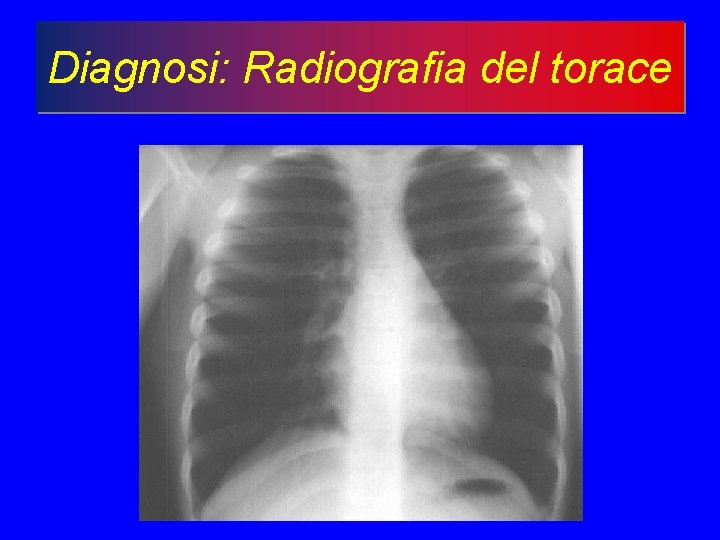 Diagnosi: Radiografia del torace 