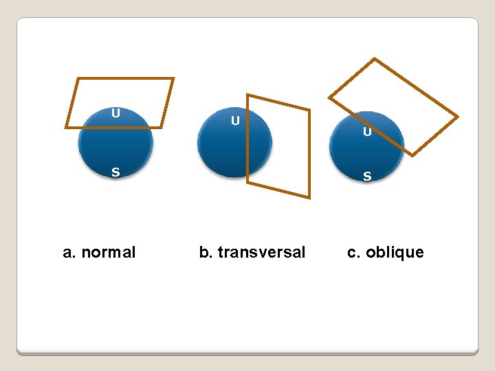 U U S a. normal U S b. transversal c. oblique 