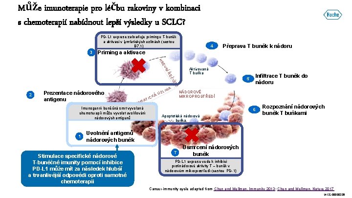 Může imunoterapie pro léčbu rakoviny v kombinaci s chemoterapií nabídnout lepší výsledky u SCLC?