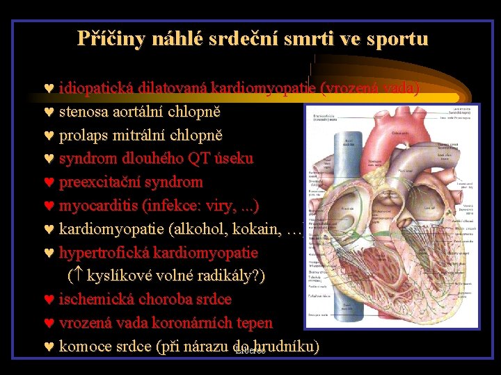 Příčiny náhlé srdeční smrti ve sportu idiopatická dilatovaná kardiomyopatie (vrozená vada) stenosa aortální chlopně