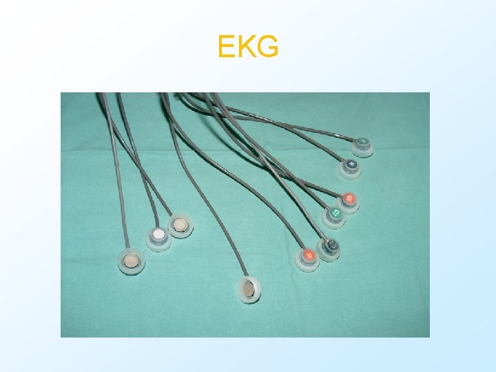 EKG 