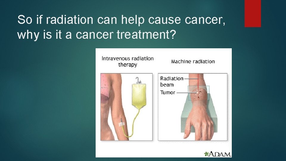 So if radiation can help cause cancer, why is it a cancer treatment? 