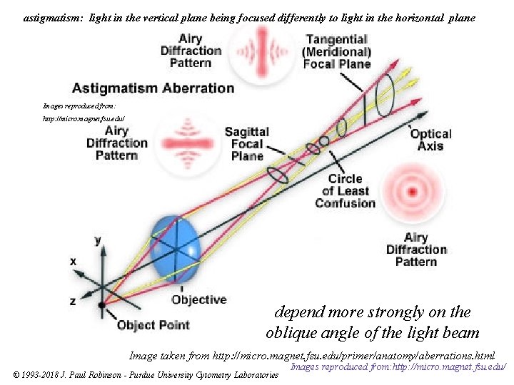 astigmatism: light in the vertical plane being focused differently to light in the horizontal