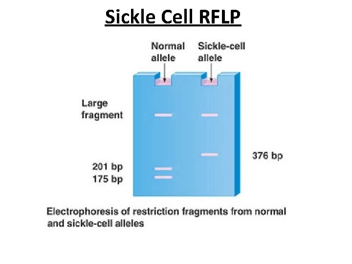 Sickle Cell RFLP 