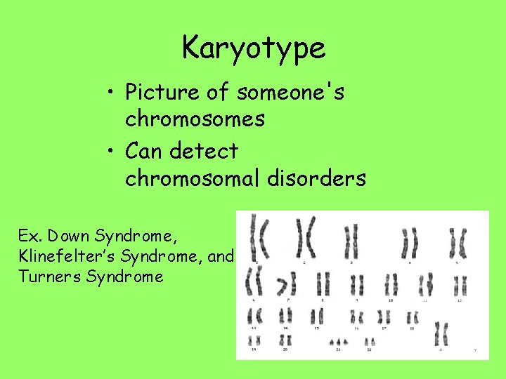 Karyotype • Picture of someone's chromosomes • Can detect chromosomal disorders Ex. Down Syndrome,