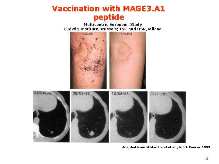 Vaccination with MAGE 3. A 1 peptide Multicentric European Study Ludwig Institute, Brussels; INT