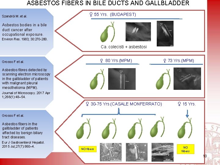 ASBESTOS FIBERS IN BILE DUCTS AND GALLBLADDER Szendröi M. et al. ♀ 55 Yrs.