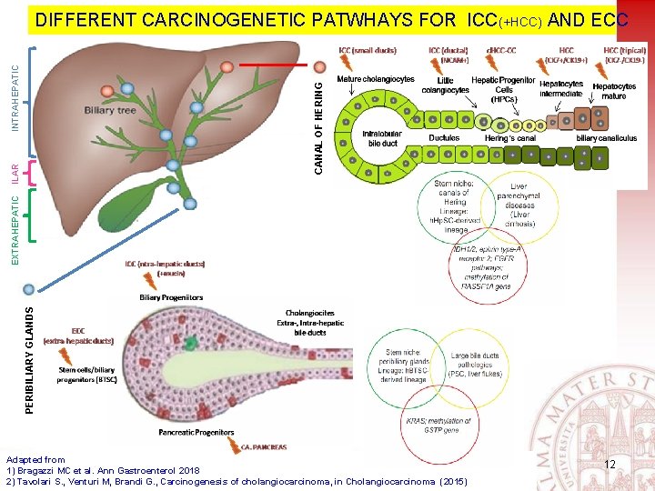 PERIBILIARY GLANDS EXTRAHEPATIC ILAR CANAL OF HERING INTRAHEPATIC DIFFERENT CARCINOGENETIC PATWHAYS FOR ICC(+HCC) AND