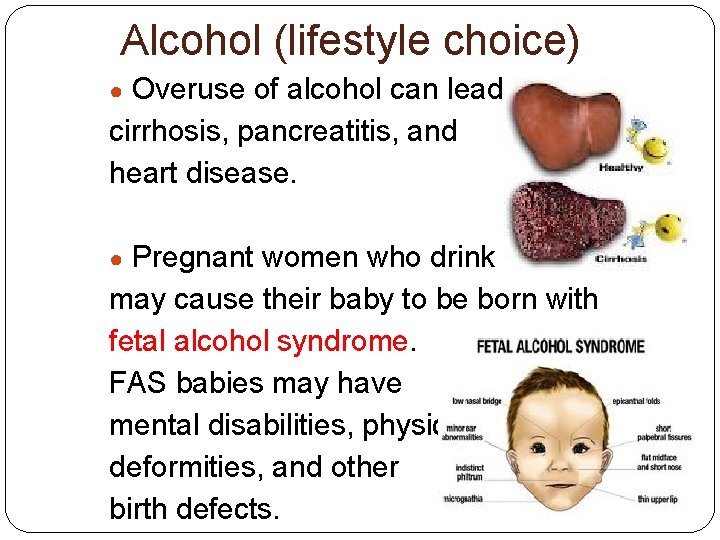 Alcohol (lifestyle choice) Overuse of alcohol can lead to cirrhosis, pancreatitis, and heart disease.