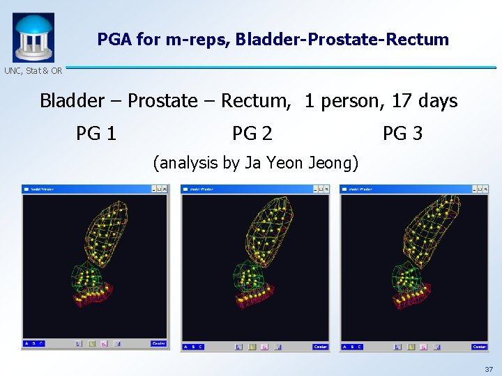 PGA for m-reps, Bladder-Prostate-Rectum UNC, Stat & OR Bladder – Prostate – Rectum, 1