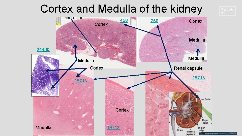Cortex and Medulla of the kidney Minor calyces 458 Cortex 260 Cortex Medulla 34400