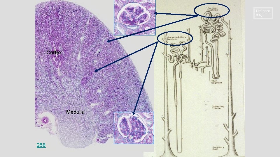Ref code # 6, Cortex Medulla 258 