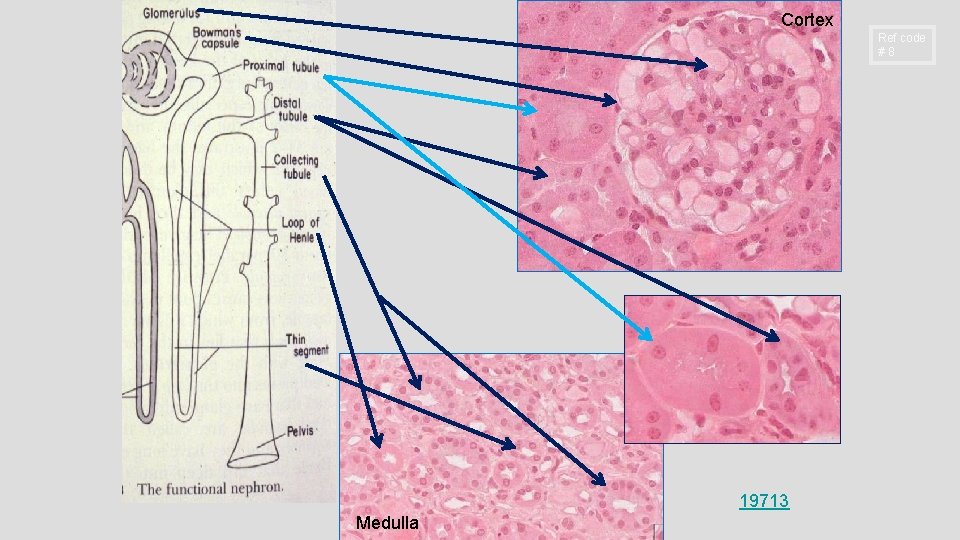 Cortex Ref code #8 19713 Medulla 