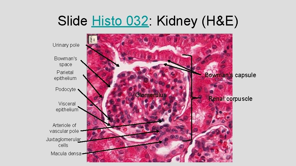 Slide Histo 032: Kidney (H&E) Urinary pole Bowman's space Parietal epithelium Podocyte Visceral epithelium