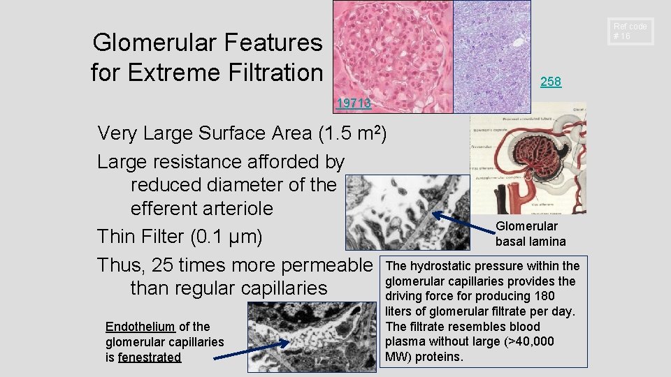 Ref code # 16 Glomerular Features for Extreme Filtration 258 19713 Very Large Surface