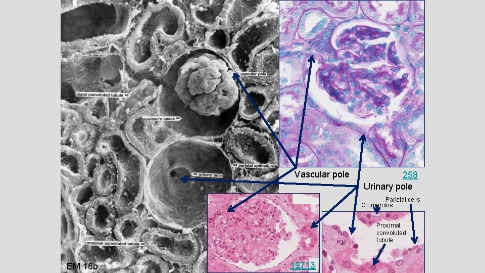 Vascular pole 258 Urinary pole Parietal cells Glomerulus Proximal convoluted tubule EM 18 b