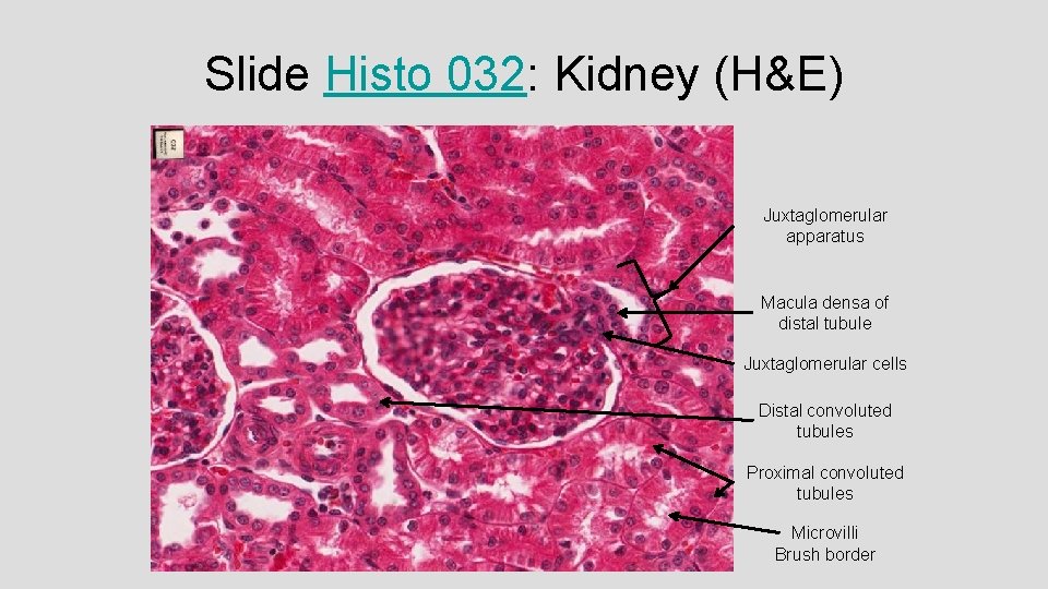 Slide Histo 032: Kidney (H&E) Juxtaglomerular apparatus Macula densa of distal tubule Juxtaglomerular cells