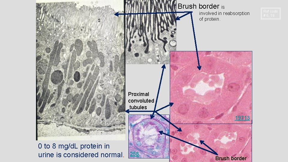 Brush border is involved in reabsorption of protein. Proximal convoluted tubules 19713 0 to