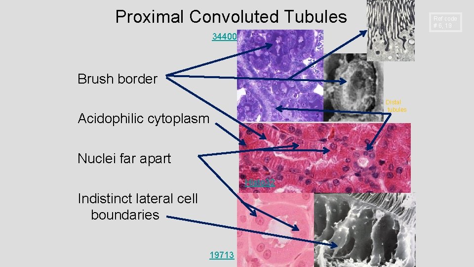 Proximal Convoluted Tubules Ref code # 6, 19 34400 Brush border Distal tubules Acidophilic