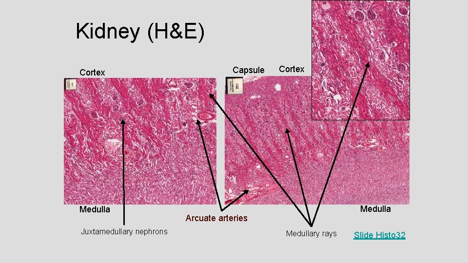 Kidney (H&E) Cortex Medulla Juxtamedullary nephrons Capsule Cortex Medulla Arcuate arteries Medullary rays Slide