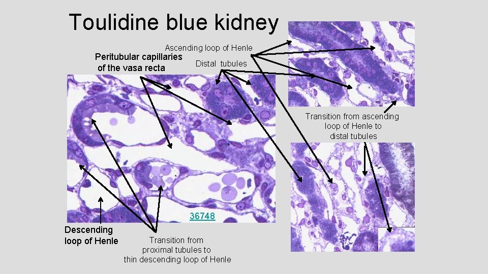 Toulidine blue kidney Ascending loop of Henle Peritubular capillaries of the vasa recta Distal