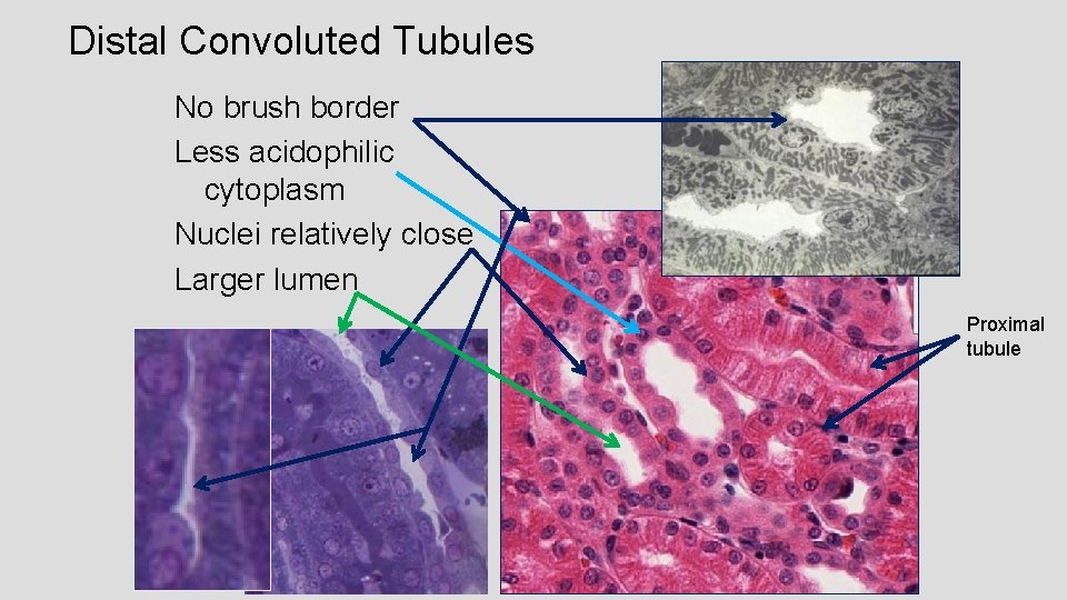 Distal Convoluted Tubules No brush border Less acidophilic cytoplasm Nuclei relatively close Larger lumen
