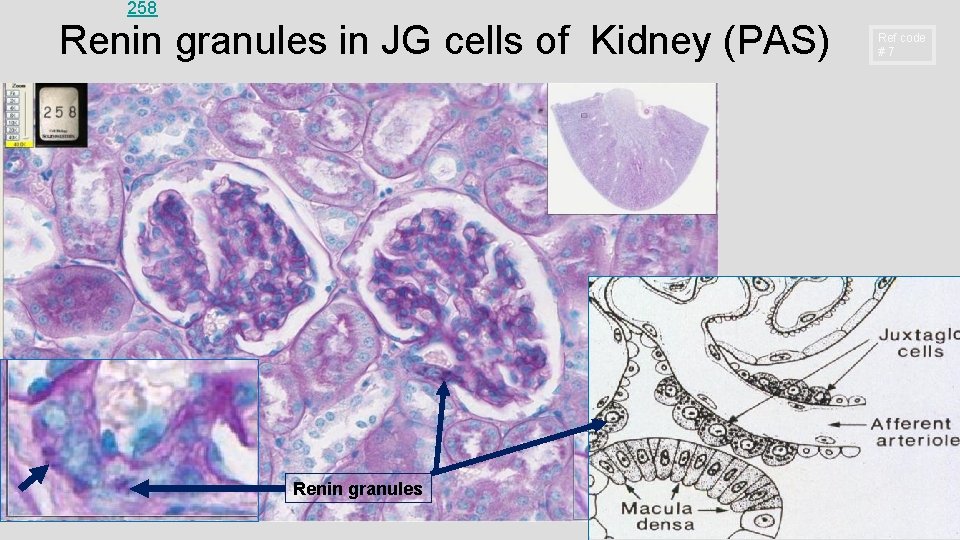 258 Renin granules in JG cells of Kidney (PAS) Renin granules Ref code #7