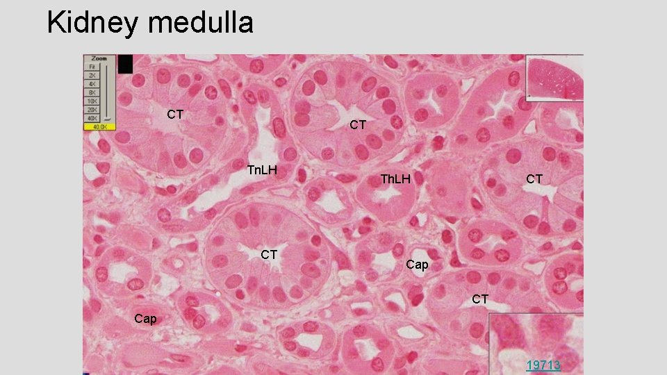 Kidney medulla CT CT Tn. LH CT Th. LH CT Cap 19713 