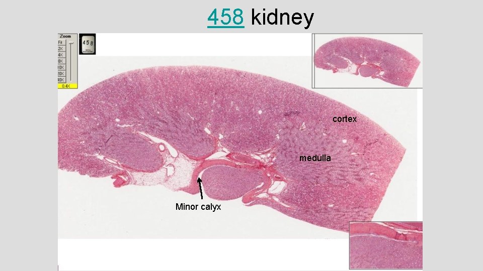 458 kidney cortex medulla Minor calyx 