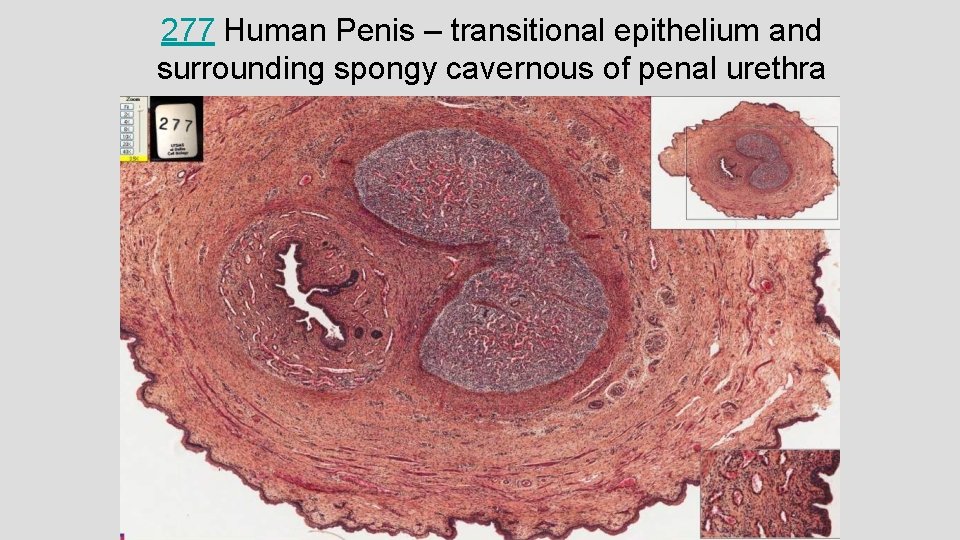 277 Human Penis – transitional epithelium and surrounding spongy cavernous of penal urethra 