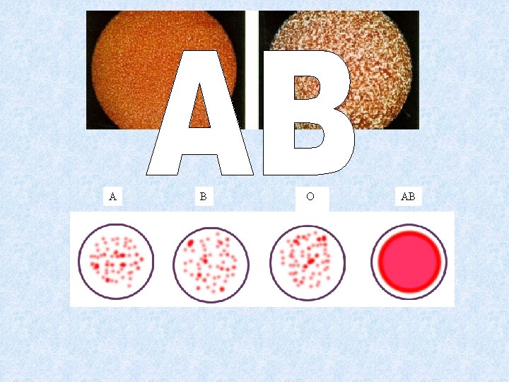 A B O AB 