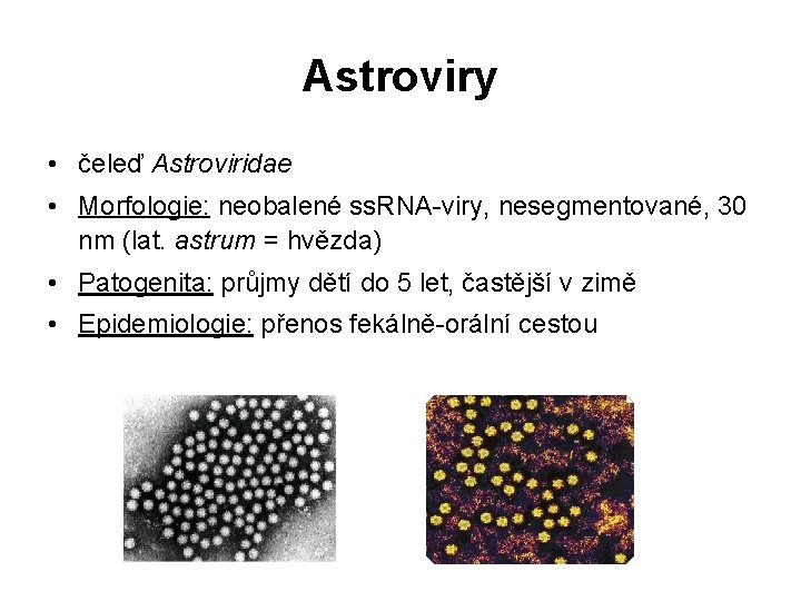 Astroviry • čeleď Astroviridae • Morfologie: neobalené ss. RNA-viry, nesegmentované, 30 nm (lat. astrum