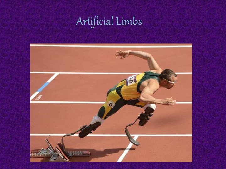 Artificial Limbs 