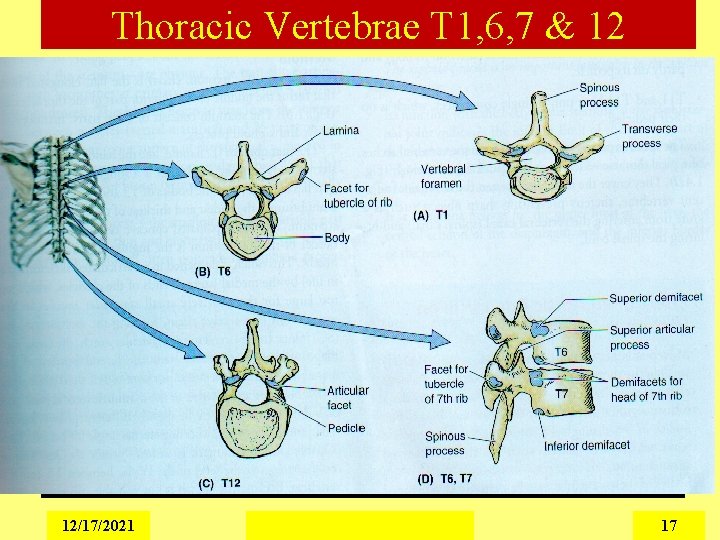 Thoracic Vertebrae T 1, 6, 7 & 12 12/17/2021 17 