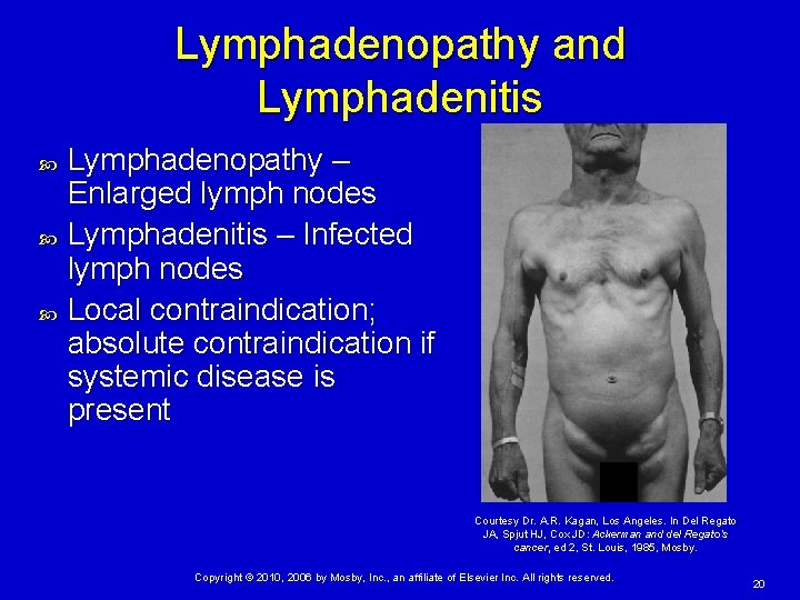 Lymphadenopathy and Lymphadenitis Lymphadenopathy – Enlarged lymph nodes Lymphadenitis – Infected lymph nodes Local