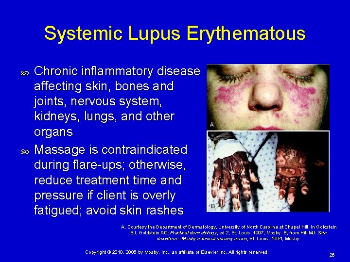 Systemic Lupus Erythematous Chronic inflammatory disease affecting skin, bones and joints, nervous system, kidneys,
