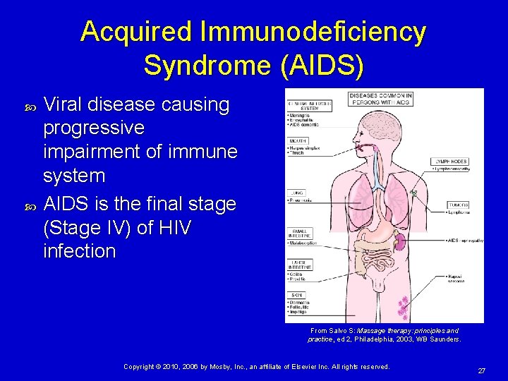 Acquired Immunodeficiency Syndrome (AIDS) Viral disease causing progressive impairment of immune system AIDS is