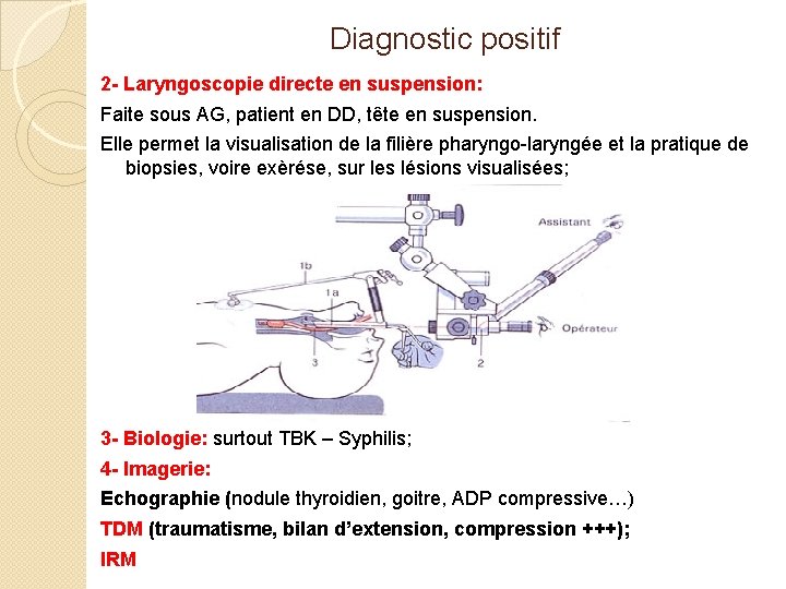 Diagnostic positif 2 - Laryngoscopie directe en suspension: Faite sous AG, patient en DD,