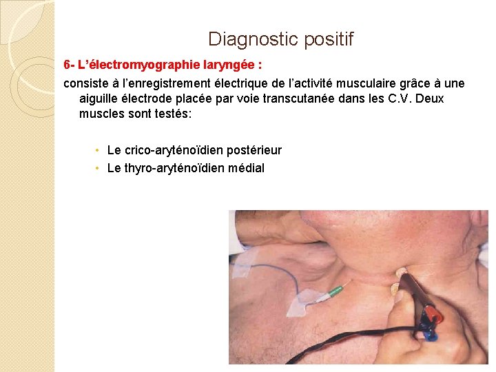Diagnostic positif 6 - L’électromyographie laryngée : consiste à l’enregistrement électrique de l’activité musculaire