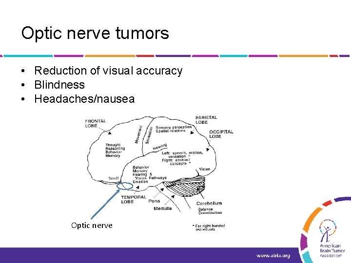 Optic nerve tumors • Reduction of visual accuracy • Blindness • Headaches/nausea Optic nerve