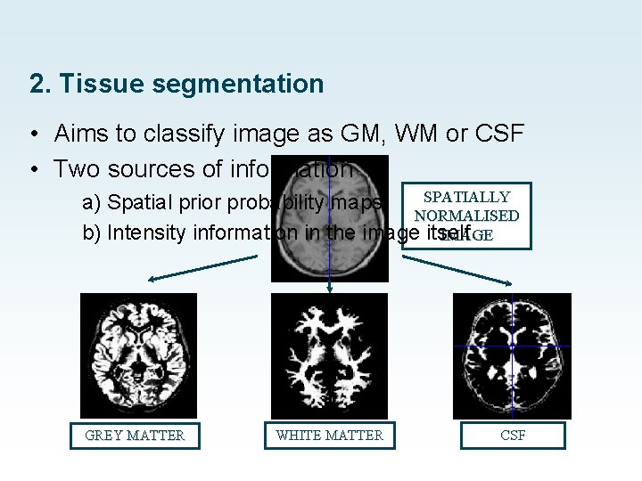 2. Tissue segmentation • Aims to classify image as GM, WM or CSF •