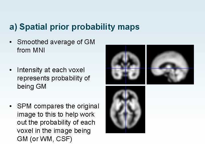 a) Spatial prior probability maps • Smoothed average of GM from MNI • Intensity