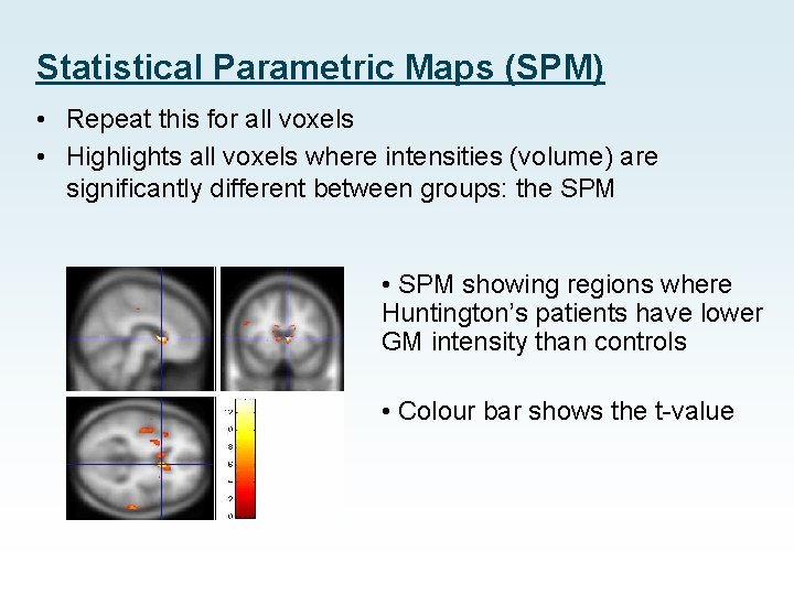 Statistical Parametric Maps (SPM) • Repeat this for all voxels • Highlights all voxels