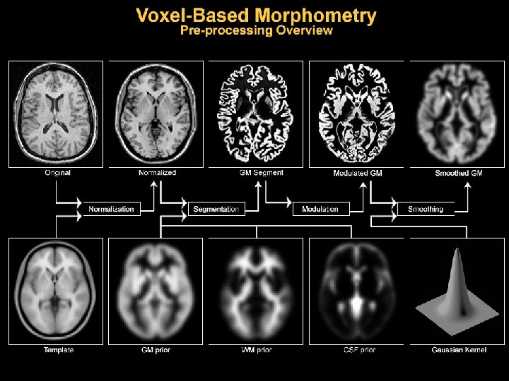 VBM Processing 