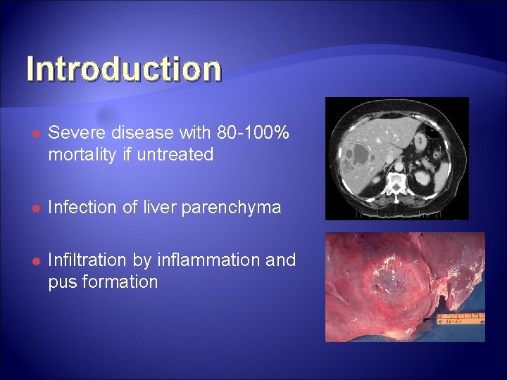 Introduction Severe disease with 80 -100% mortality if untreated Infection of liver parenchyma Infiltration Introduction Severe disease with 80 -100% mortality if untreated Infection of liver parenchyma Infiltration