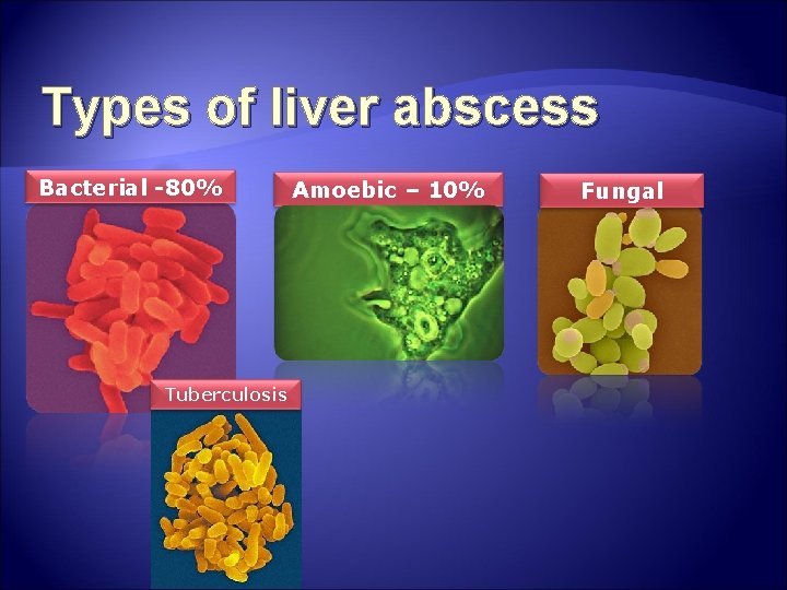 Types of liver abscess Bacterial -80% Tuberculosis Amoebic – 10% Fungal Types of liver abscess Bacterial -80% Tuberculosis Amoebic – 10% Fungal